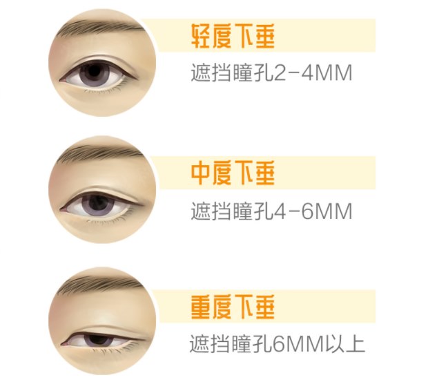 圖片.png